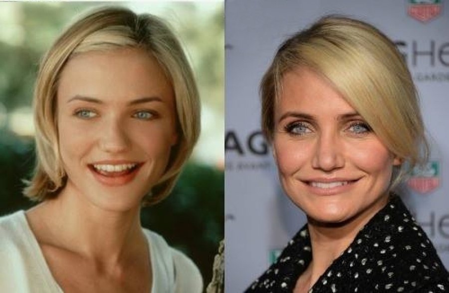 Как выглядели голливудские звезды до пластики