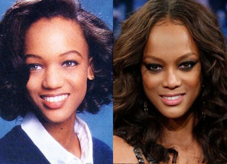 Как выглядели голливудские звезды до пластики