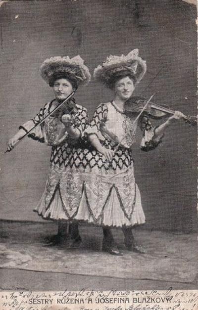 Самые известные истории сиамских близнецов