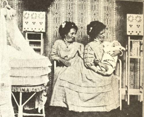 Самые известные истории сиамских близнецов