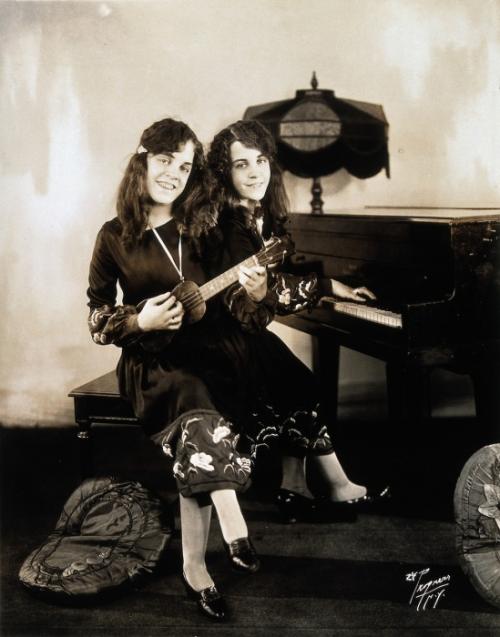 Самые известные истории сиамских близнецов