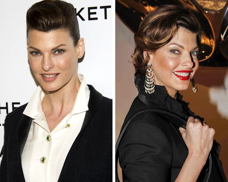 Знаменитости, которые комплексуют из-за внешности