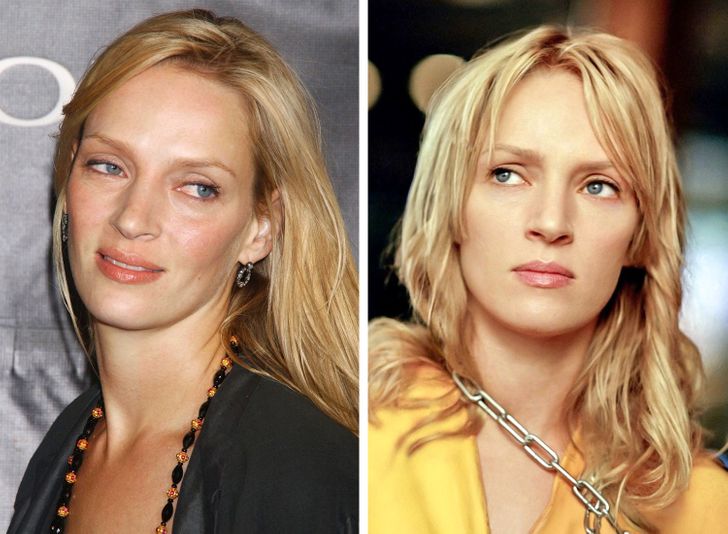 Знаменитости, которые комплексуют из-за внешности