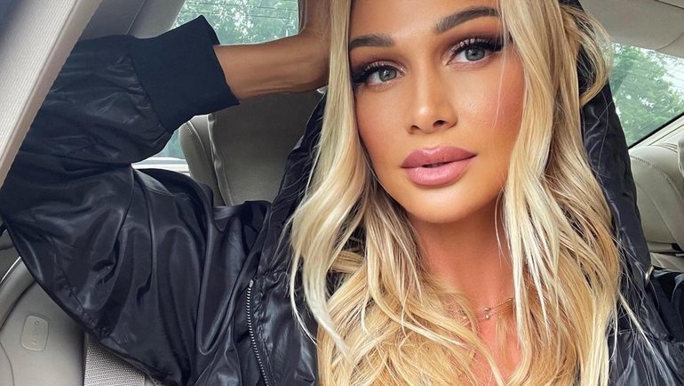 Как выглядели российские звезды до пластики: редкие фото