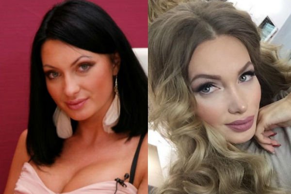 Как выглядели российские звезды до пластики: редкие фото