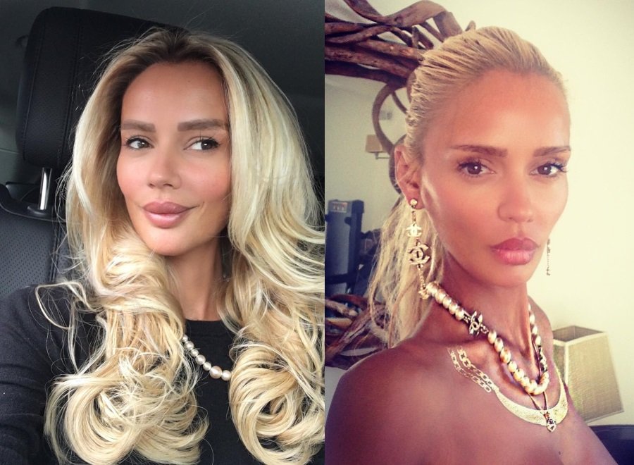 Как выглядели российские звезды до пластики: редкие фото