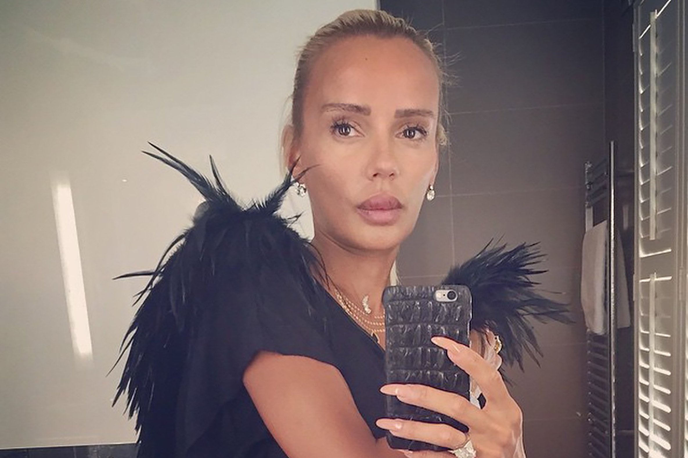 Как выглядели российские звезды до пластики: редкие фото