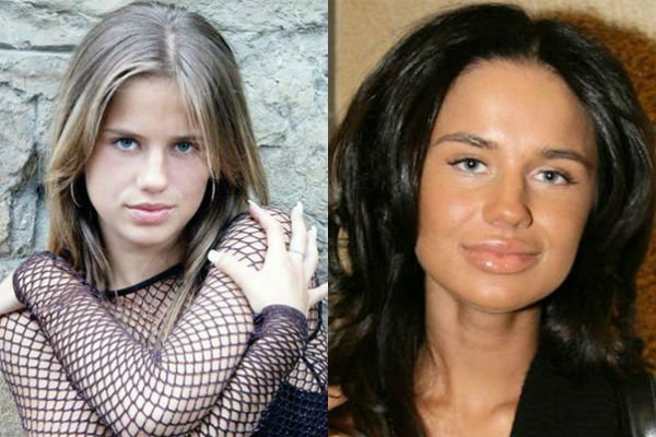 Как выглядели российские звезды до пластики: редкие фото