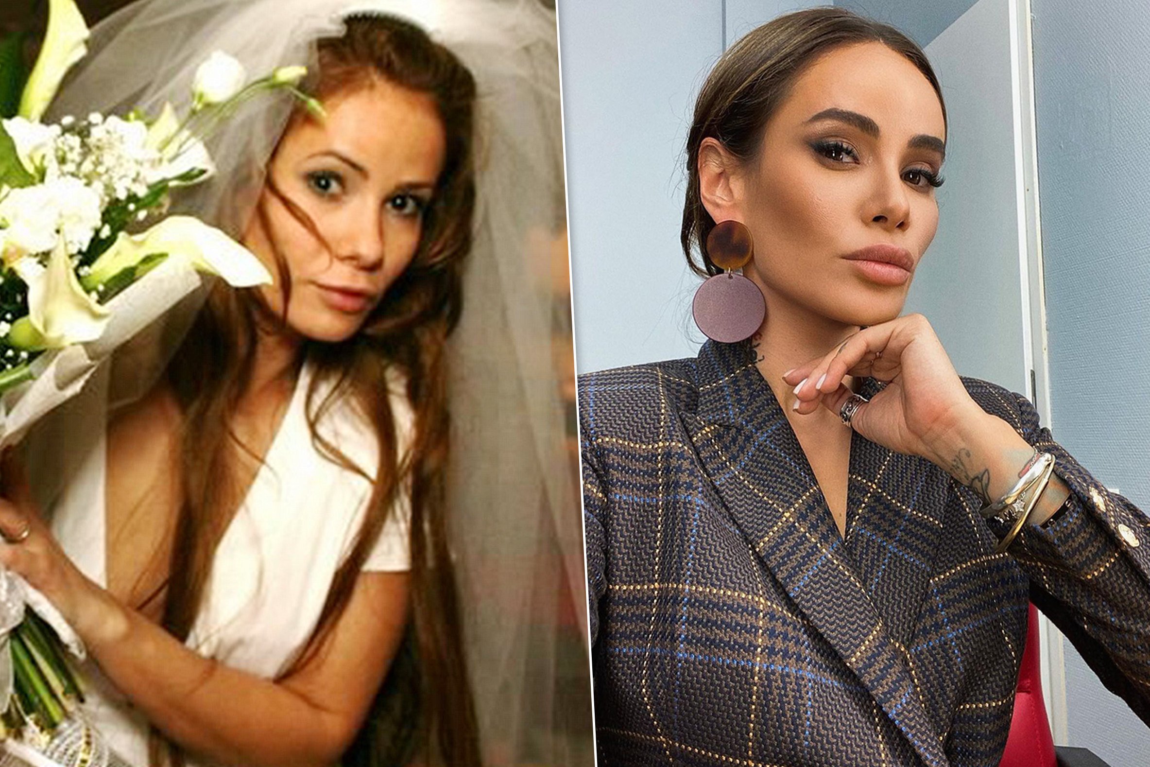 Как выглядели российские звезды до пластики: редкие фото