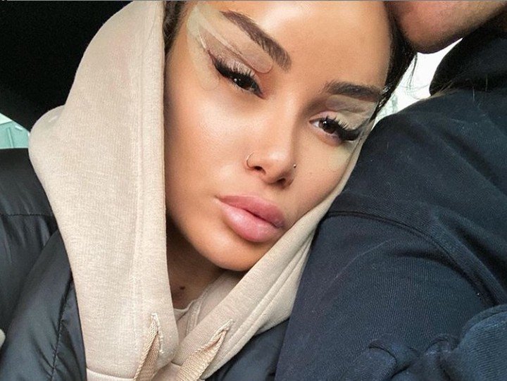 Как выглядели российские звезды до пластики: редкие фото