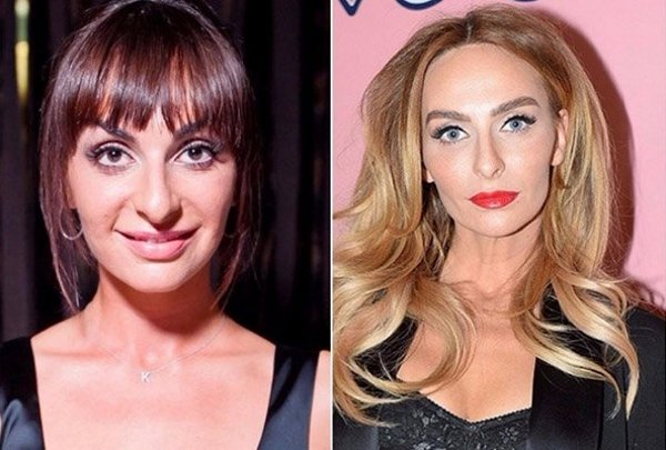 Как выглядели российские звезды до пластики: редкие фото