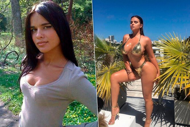 Как выглядели российские звезды до пластики: редкие фото