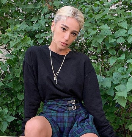 Как выглядели российские звезды до пластики: редкие фото