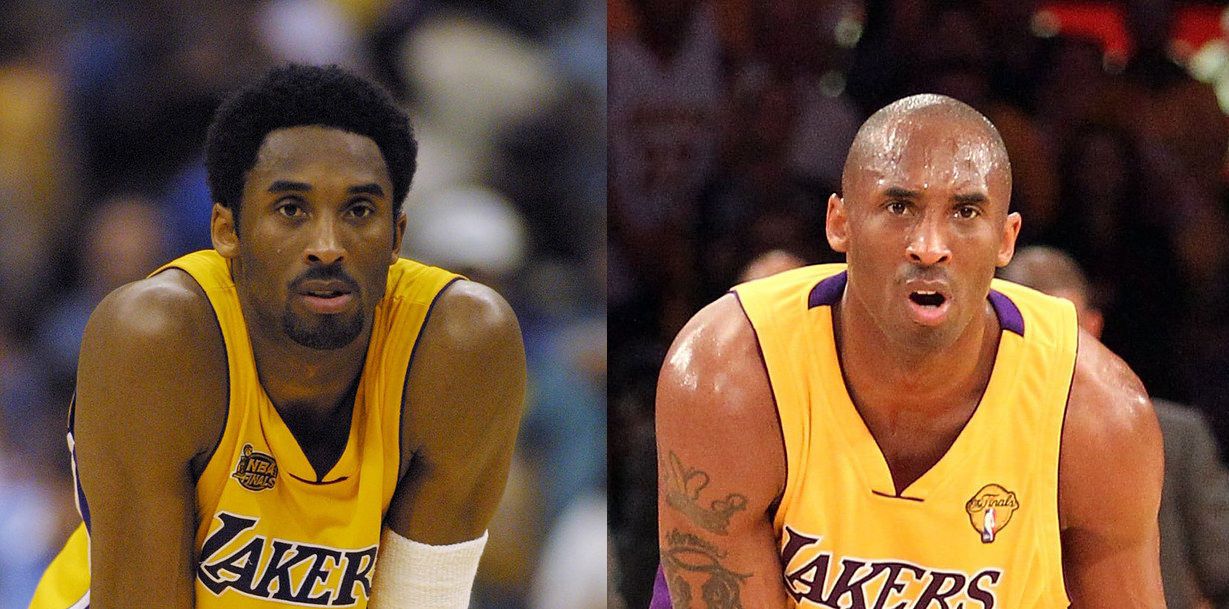 Как выглядели лысые знаменитости до того, как потеряли волосы