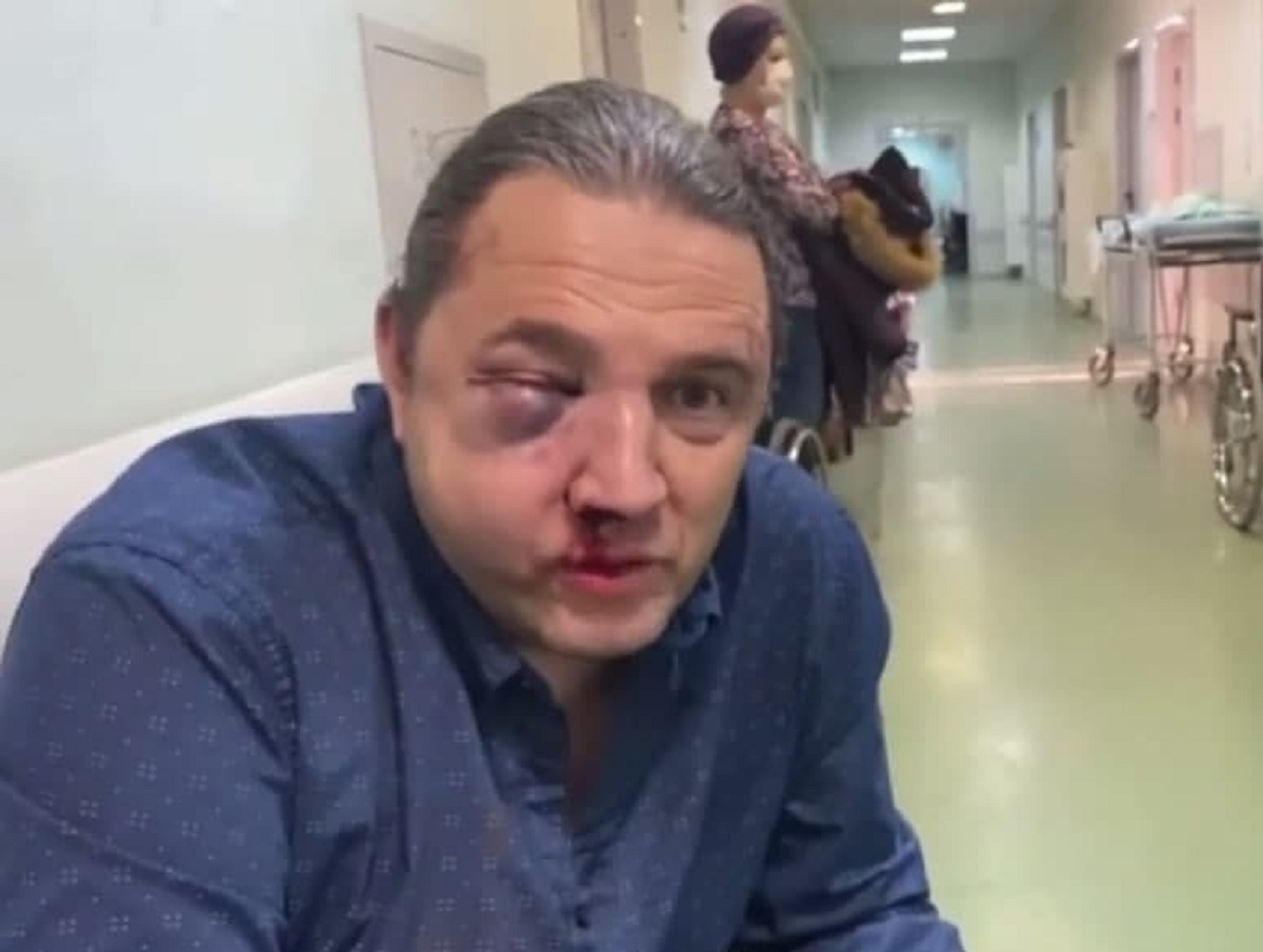Избиение экс-депутата Госдумы Максимы Шингаркина попало на видео