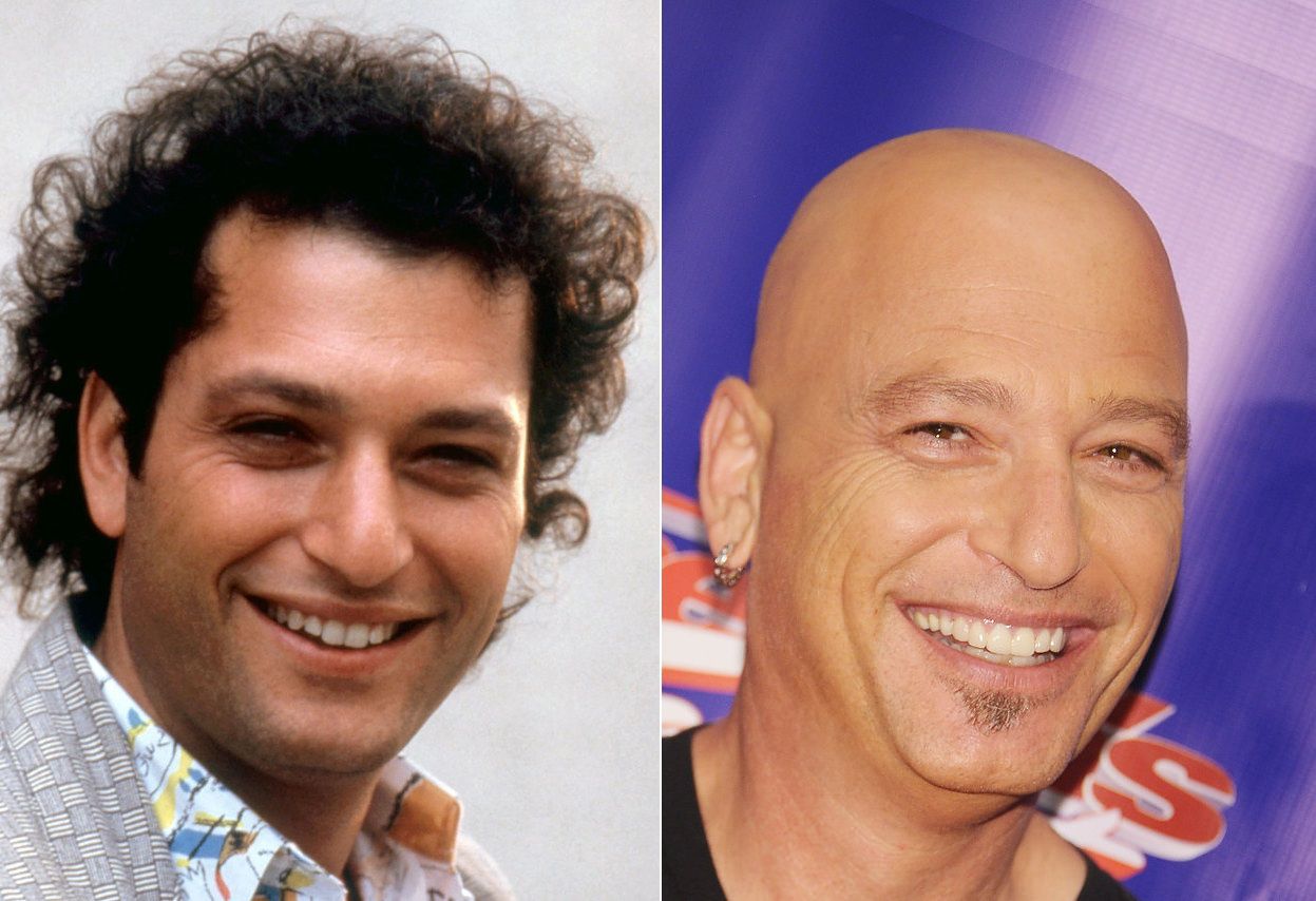 Как выглядели лысые знаменитости до того, как потеряли волосы