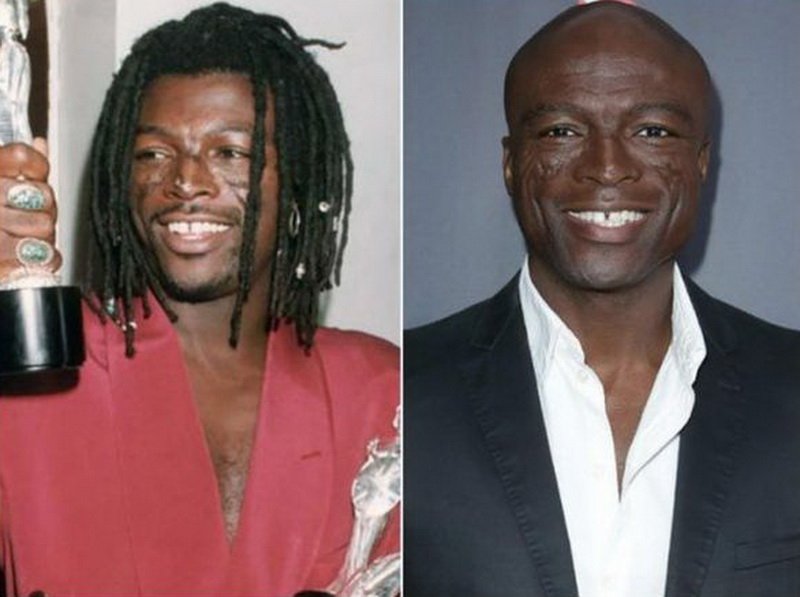 Как выглядели лысые знаменитости до того, как потеряли волосы