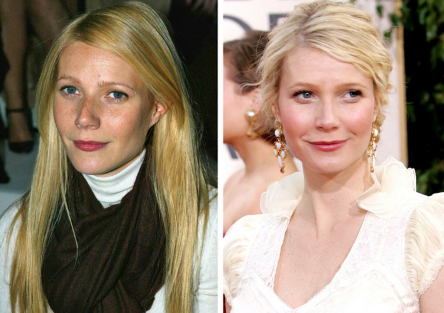 Как менялись лица знаменитостей во время беременности