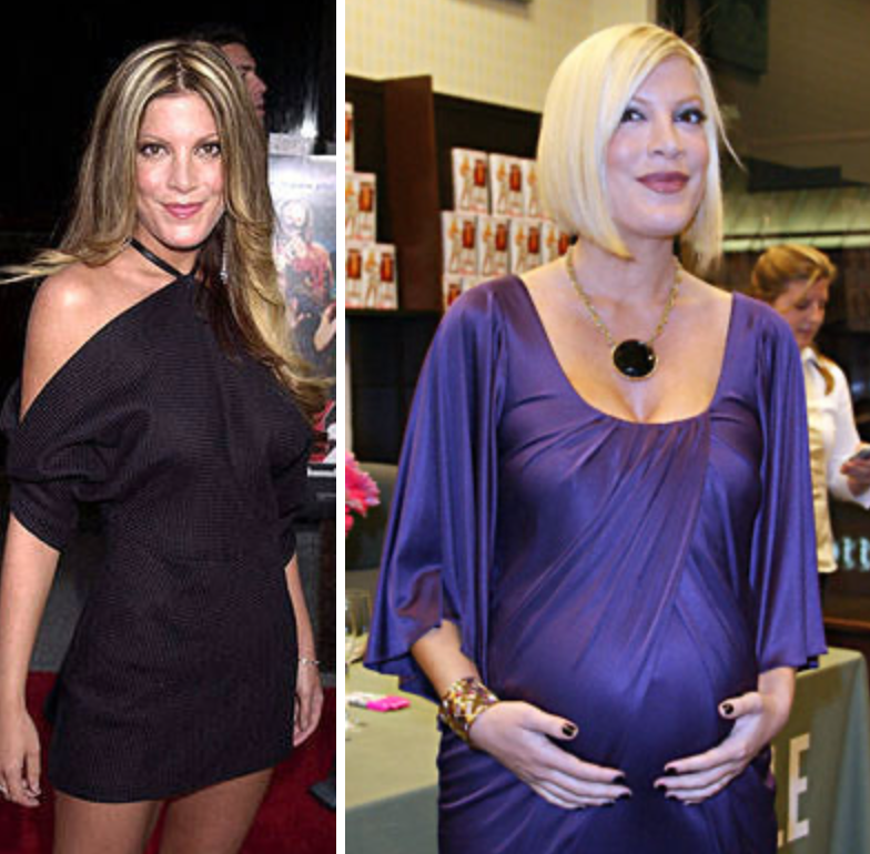 Как менялись лица знаменитостей во время беременности