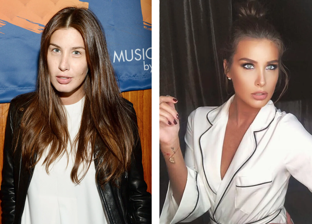 Звезды, которые после расставания стали выглядеть еще лучше