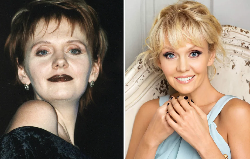 Звезды, которые после расставания стали выглядеть еще лучше