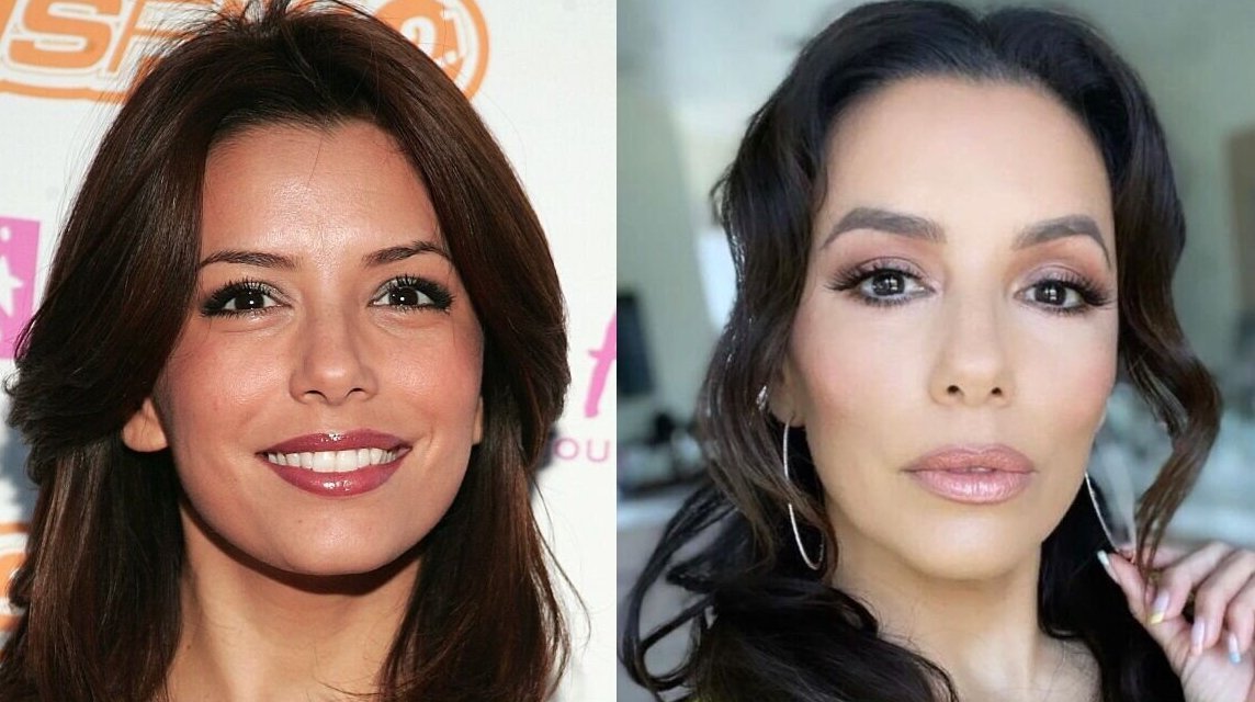 Звезды, которые отказались от пластической хирургии, оставаясь по прежнему красивыми