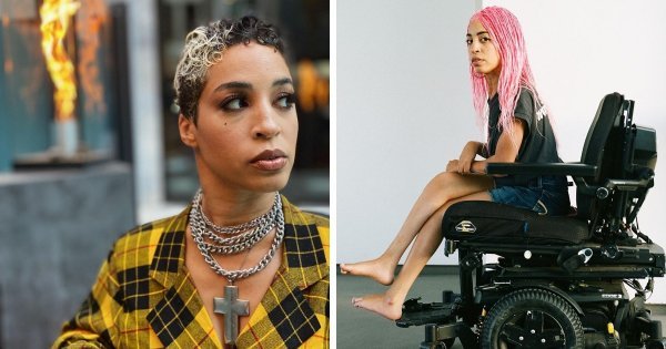 Модели с нетипичной внешностью, которые добились успеха