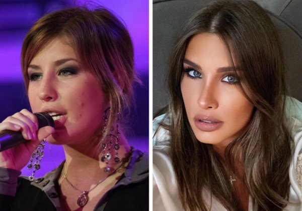 Крупным планом: как изменились за 20 лет российские знаменитости из «нулевых»