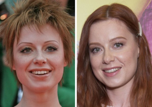 Крупным планом: как изменились за 20 лет российские знаменитости из «нулевых»