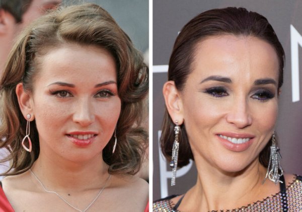 Крупным планом: как изменились за 20 лет российские знаменитости из «нулевых»