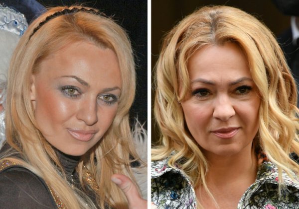 Крупным планом: как изменились за 20 лет российские знаменитости из «нулевых»