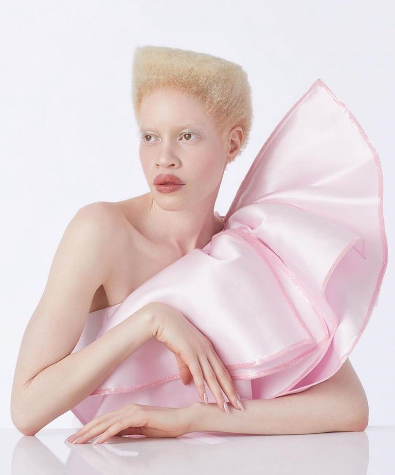 Модели с нетипичной внешностью, которые добились успеха