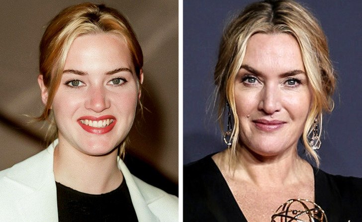 Звезды, которые отказались от пластической хирургии, оставаясь по прежнему красивыми