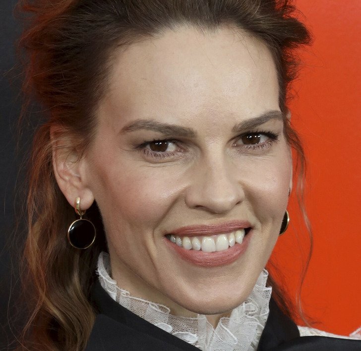 Знаменитости с неидеальными зубами