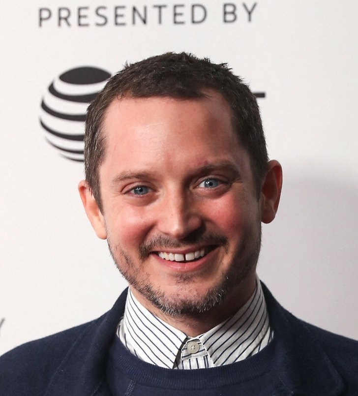 Знаменитости с неидеальными зубами