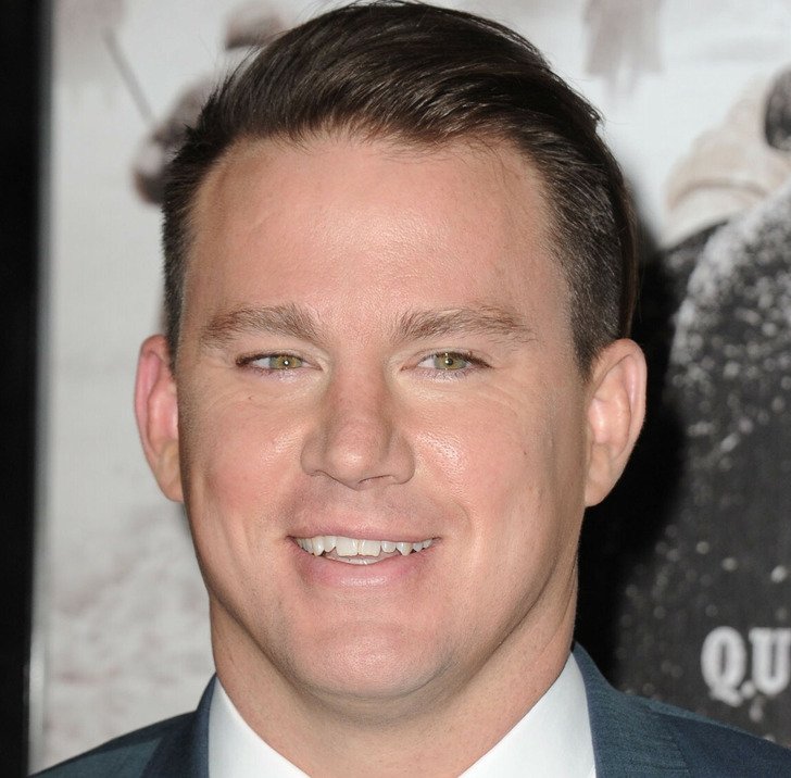 Знаменитости с неидеальными зубами