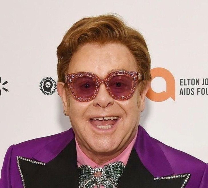 Знаменитости с неидеальными зубами