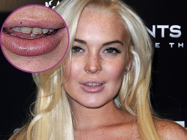 Знаменитости с неидеальными зубами