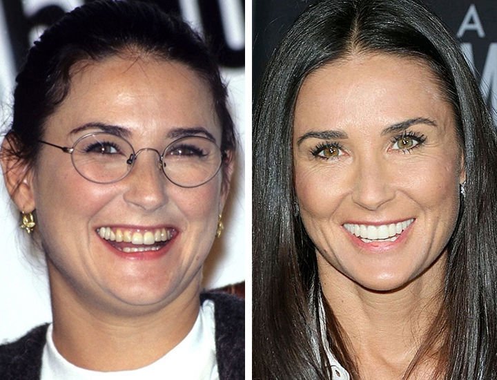 Знаменитости с неидеальными зубами