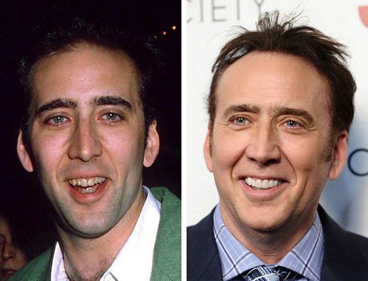 Знаменитости с неидеальными зубами