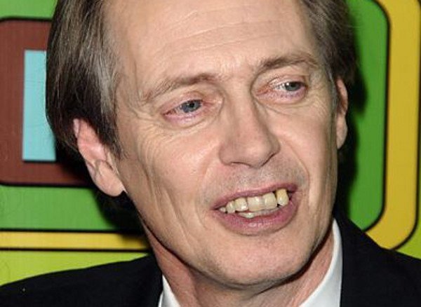 Знаменитости с неидеальными зубами