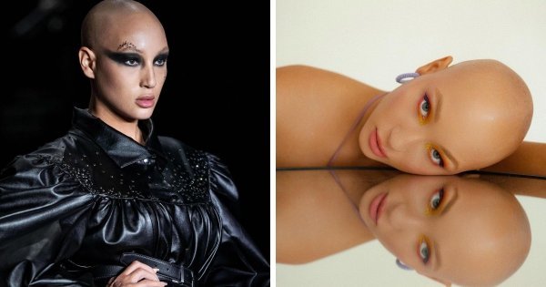 Модели с нетипичной внешностью, которые добились успеха