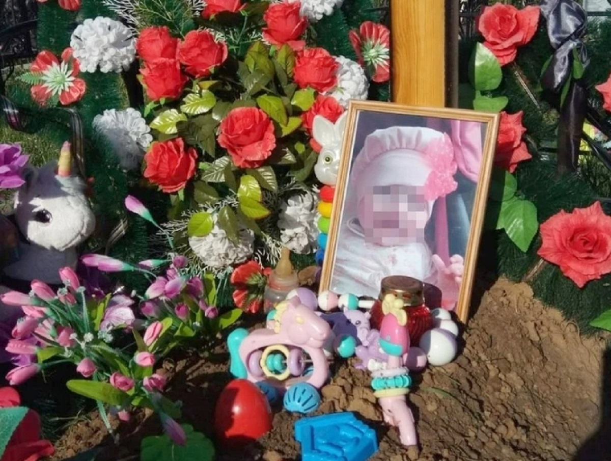 Полугодовалая девочка в Сибири умерла после исправления заячьей губы