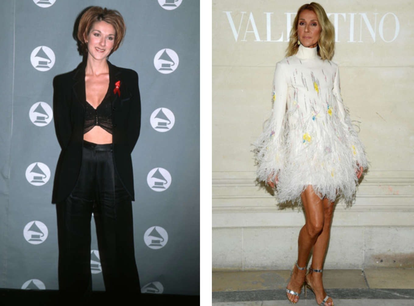 Звезды, которые начинали с невзрачных образов, а теперь считаются иконами стиля