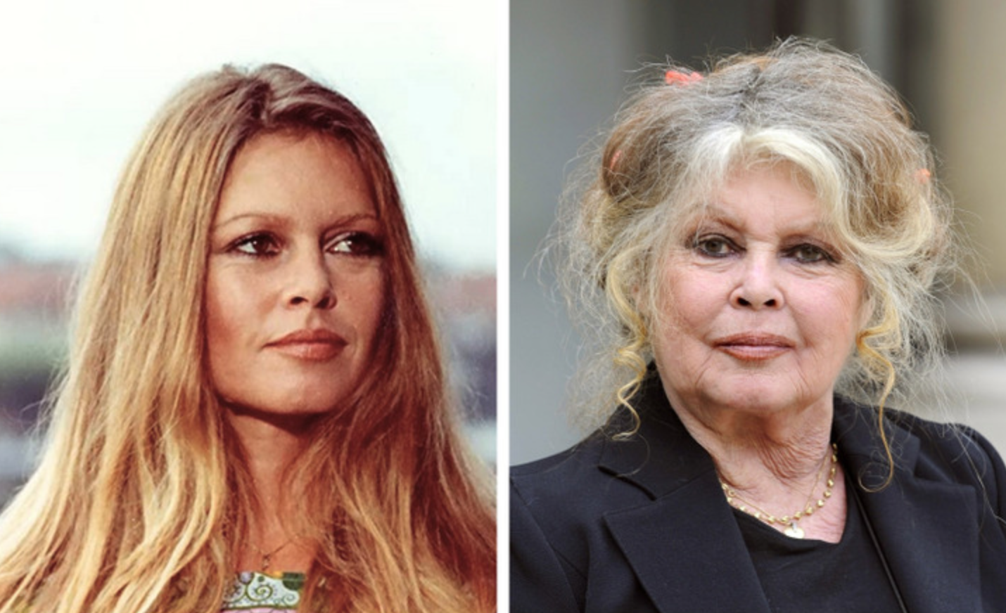 Звезды, которые отказались от пластической хирургии, оставаясь по прежнему красивыми