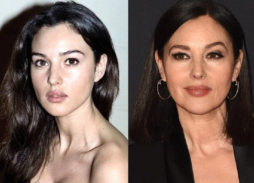 Звезды, которые отказались от пластической хирургии, оставаясь по прежнему красивыми