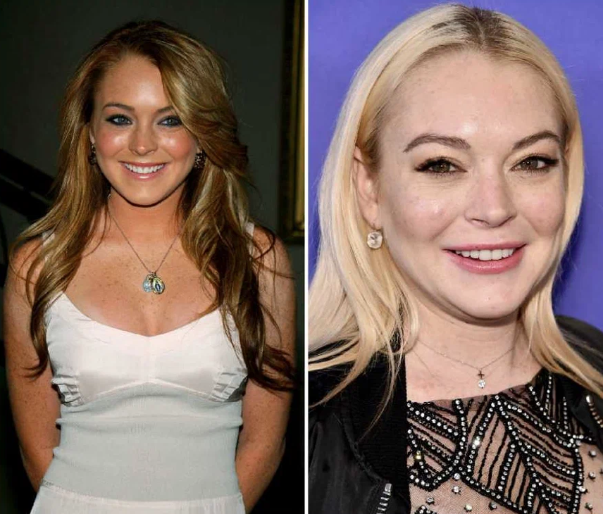 Звезды, которые легли под нож, и изменились до неузнаваемости