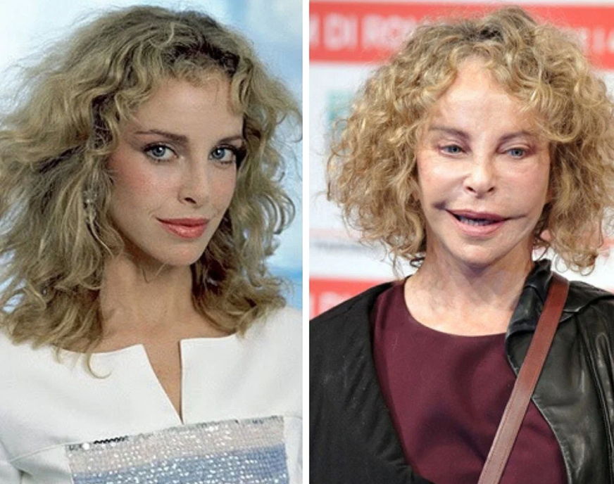 Звезды, которые легли под нож, и изменились до неузнаваемости