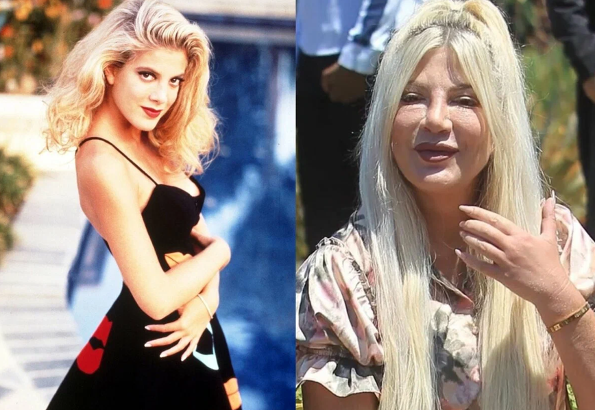 Звезды, которые легли под нож, и изменились до неузнаваемости