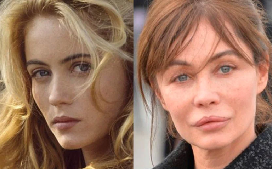 Звезды, которые легли под нож, и изменились до неузнаваемости